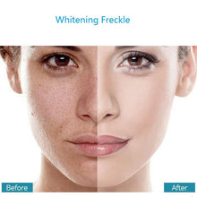 Lade das Bild in den Galerie-Viewer, Effective Whitening Freckle Cream Remove Dark Spots Anti Freckle Cream Fade Pigmentation Melasma Brighten Creams Skin Care 20g DSers