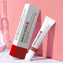 Lade das Bild in den Galerie-Viewer, Effective Whitening Freckle Cream Remove Dark Spots Anti Freckle Cream Fade Pigmentation Melasma Brighten Creams Skin Care 20g DSers