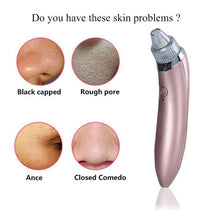 Load image into Gallery viewer, Blackhead Remover Vacuum