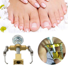 Lade das Bild in den Galerie-Viewer, INGROWN NAIL CORRECTOR