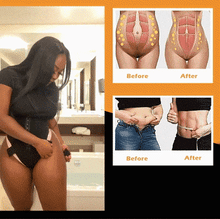 Lade das Bild in den Galerie-Viewer, RHISO™ Tummy Trainer Femme MBPPFS
