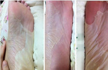 Lade das Bild in den Galerie-Viewer, Silky Feet - Deep Exfoliation Peel Socks
