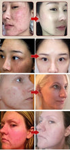 Lade das Bild in den Galerie-Viewer, 【Black Friday Sale! Buy 1 Get 1 Free】Pro-Herbal Refining Peel-Off Facial Blossom Online UG
