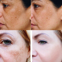 Load image into Gallery viewer, Effective Whitening Freckle Cream Remove Dark Spots Anti Freckle Cream Fade Pigmentation Melasma Brighten Creams Skin Care 20g DSers
