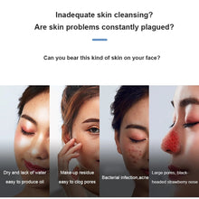 Load image into Gallery viewer, Electric Bubbles Blackhead Vacuum Cleaner Water Cycle Skin Deep Cleaning USB Rechargeable Small  Beauty Care Tools DSers
