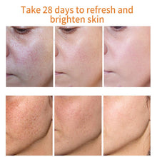 Load image into Gallery viewer, Effective Whitening Freckle Cream Remove Dark Spots Anti Freckle Cream Fade Pigmentation Melasma Brighten Creams Skin Care 20g DSers
