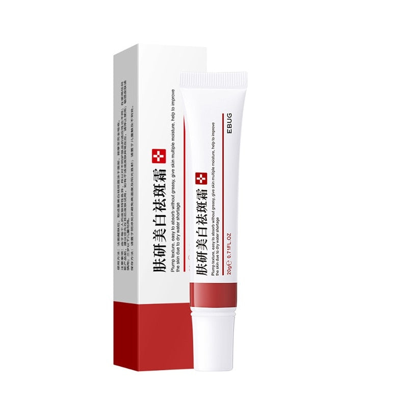Effective Whitening Freckle Cream Remove Dark Spots Anti Freckle Cream Fade Pigmentation Melasma Brighten Creams Skin Care 20g DSers