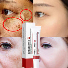 Load image into Gallery viewer, Effective Whitening Freckle Cream Remove Dark Spots Anti Freckle Cream Fade Pigmentation Melasma Brighten Creams Skin Care 20g DSers
